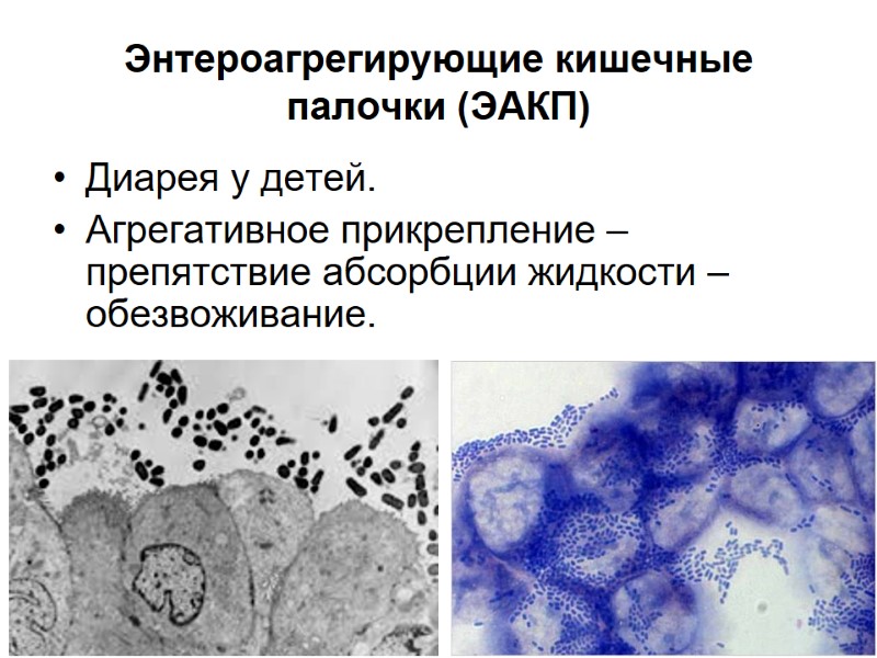 Энтероагрегирующие кишечные палочки (ЭАКП) Диарея у детей. Агрегативное прикрепление – препятствие абсорбции жидкости –